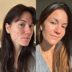 Before and After - Amanda Chen, 24, San Francisco CA